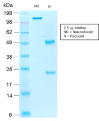 Data from SDS-PAGE analysis of Anti-PSAP antibody (Clone rAIF1/1909). Reducing lane (R) shows heavy and light chain fragments. NR lane shows intact antibody with expected MW of approximately 150 kDa. The data are consistent with a high purity, intact mAb.